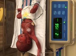Raine NICU
