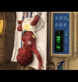 Ross NICU
